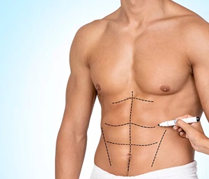 Hernia Surgery Sydney Surgery inguinal femoral direct indirect